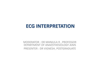 ECG INTERPRETATION
MODERATOR : DR MANJULA R , PROFESSOR
DEPARTMENT OF ANAESTHESIOLOGY AIMS
PRESENTER : DR VIGNESH, POSTGRADUATE
 