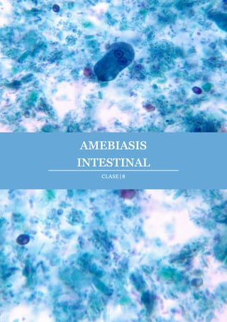 AMEBIASIS
INTESTINAL
CLASE | 8
 