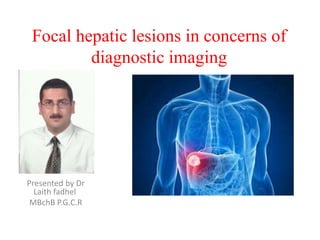 Focal hepatic lesions in concerns of
diagnostic imaging
Presented by Dr
Laith fadhel
MBchB P.G.C.R
 
