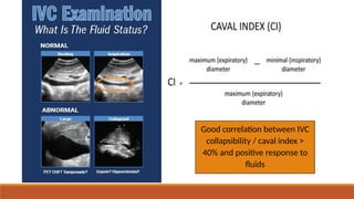 Calvadic Chart PEDIATRIC_SEPTIC_SHOCK_APPROACH.pptx presentation | PPTX