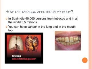 HOW THE TABACCO AFECTED IN MY BODY?
In Spain die 40.000 persons from tobacco and in all
the world 3,5 millions.
You can have cancer in the lung and in the mouth
too.