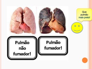 Que pulmão mais preto!