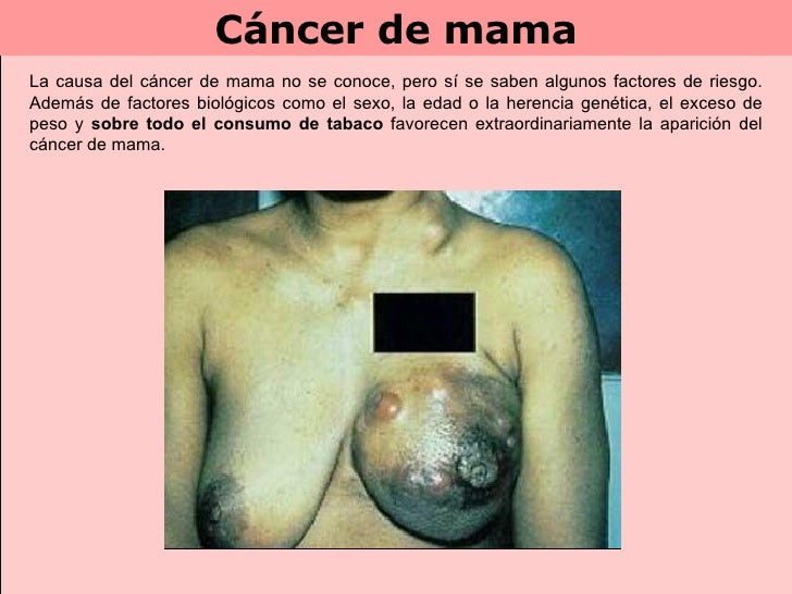 Ha dejado a fumar el fracaso nervioso