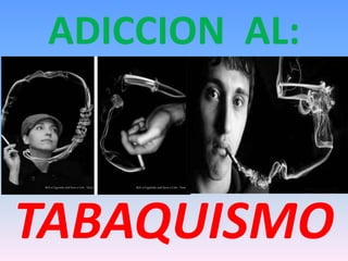 ADICCION AL:

TABAQUISMO

 