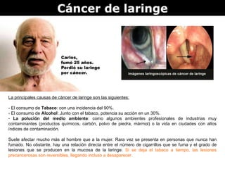 Cáncer de laringe La principales causas de cáncer de laringe son las siguientes: - El consumo de  Tabaco : con una incidencia del 90%. - El consumo de  Alcohol : Junto con el tabaco, potencia su acción en un 30%.  La polución del medio ambiente : como algunos ambientes profesionales de industrias muy contaminantes (productos químicos, carbón, polvo de piedra, mármol) o la vida en ciudades con altos índices de contaminación.  Suele afectar mucho más al hombre que a la mujer. Rara vez se presenta en personas que nunca han fumado. No obstante, hay una relación directa entre el número de cigarrillos que se fuma y el grado de lesiones que se producen en la mucosa de la laringe.  Si se deja el tabaco a tiempo, las lesiones precancerosas son reversibles, llegando incluso a desaparecer.   