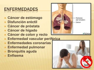 ENFERMEDADES
 Cáncer de estómago
 Disfunción eréctil
 Cáncer de próstata
 Cáncer de hígado
 Cáncer de colon y recto
 Enfermedad vascular periférica
 Enfermedades coronarias
 Enfermedad pulmonar
 Bronquitis aguda
 Enfisema
 