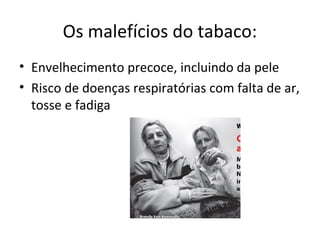 Os malefícios do tabaco:
• Envelhecimento precoce, incluindo da pele
• Risco de doenças respiratórias com falta de ar,
tosse e fadiga
 