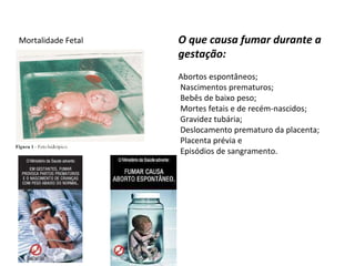 Mortalidade Fetal O que causa fumar durante a gestação: Abortos espontâneos;  Nascimentos prematuros;  Bebês de baixo peso;  Mortes fetais e de recém-nascidos;  Gravidez tubária;  Deslocamento prematuro da placenta;  Placenta prévia e  Episódios de sangramento. 