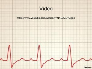 Vídeo
https://www.youtube.com/watch?v=NXUXZUvGgpo
 