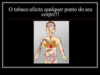 O tabaco afecta qualquer ponto do seu corpo!!! 