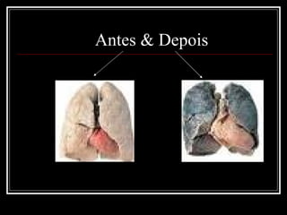 Antes & Depois 