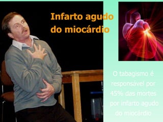 Infarto agudo do miocárdio O tabagismo é responsável por 45% das mortes por infarto agudo do miocárdio 