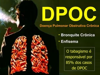 DPOC Doença Pulmonar Obstrutiva Crônica Bronquite Crônica Enfisema O tabagismo é  responsável por  85% dos casos  de DPOC 