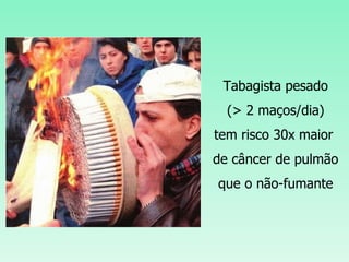 Tabagista pesado (> 2 maços/dia) tem risco 30x maior  de câncer de pulmão que o não-fumante 