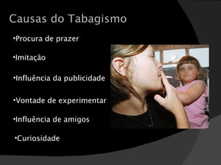 Causas do Tabagismo Procura de prazer Imitação Influência da publicidade Vontade de experimentar Influência de amigos Curiosidade 