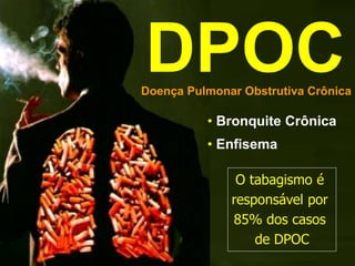 DPOC
Doença Pulmonar Obstrutiva Crônica
• Bronquite Crônica
• Enfisema
O tabagismo é
responsável por
85% dos casos
de DPOC
 