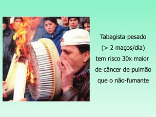 Tabagista pesado
(> 2 maços/dia)
tem risco 30x maior
de câncer de pulmão
que o não-fumante
 