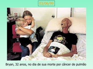 03/06/99
Bryan, 32 anos, no dia de sua morte por câncer de pulmão
 