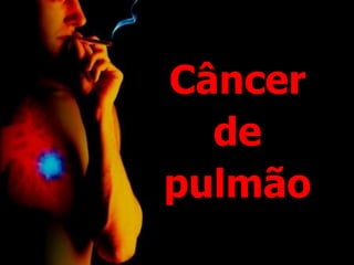 Câncer
de
pulmão
 