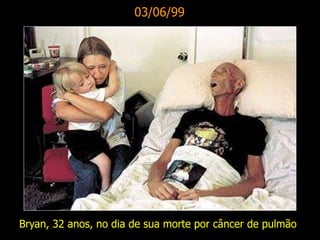 03/06/99
Bryan, 32 anos, no dia de sua morte por câncer de pulmão
 
