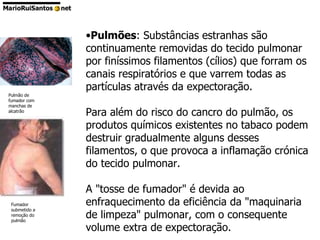 Pulmões : Substâncias estranhas são continuamente removidas do tecido pulmonar por finíssimos filamentos (cílios) que forram os canais respiratórios e que varrem todas as partículas através da expectoração.  Para além do risco do cancro do pulmão, os produtos químicos existentes no tabaco podem destruir gradualmente alguns desses filamentos, o que provoca a inflamação crónica do tecido pulmonar.  A "tosse de fumador" é devida ao enfraquecimento da eficiência da "maquinaria de limpeza" pulmonar, com o consequente volume extra de expectoração. Pulmão de fumador com manchas de alcatrão Fumador submetido a remoção do pulmão 