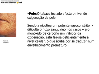 Pele :O tabaco inalado afecta o nível de oxigenação da pele. Sendo a nicotina um potente vasoconstritor - dificulta o fluxo sanguíneo nos vasos – e o monóxido de carbono um inibidor da oxigenação, esta faz-se deficientemente a nível celular, o que acaba por se traduzir num envelhecimento prematuro. Pele de fumador  