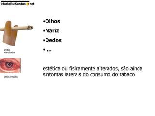 Olhos Nariz Dedos .... estética ou fisicamente alterados, são ainda sintomas laterais do consumo do tabaco  Dedos manchados  Olhos irritados  