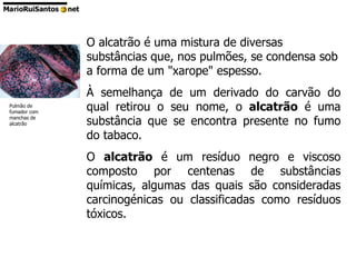 O alcatrão é uma mistura de diversas substâncias que, nos pulmões, se condensa sob a forma de um "xarope" espesso. À semelhança de um derivado do carvão do qual retirou o seu nome, o  alcatrão  é uma substância que se encontra presente no fumo do tabaco.  O  alcatrão  é um resíduo negro e viscoso composto por centenas de substâncias químicas, algumas das quais são consideradas carcinogénicas ou classificadas como resíduos tóxicos.  Pulmão de fumador com manchas de alcatrão 