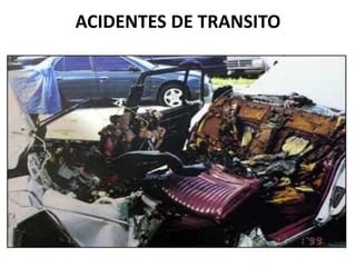 ACIDENTES DE TRANSITO
 