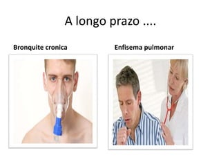 A longo prazo ....
Bronquite cronica Enfisema pulmonar
 