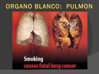 ORGANO BLANCO:  PULMON 