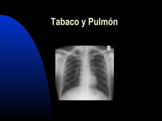 Tabaco y Pulmón
 