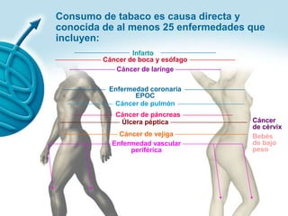 InfartoCáncer de boca y esófagoCáncer de laringeEnfermedad coronaria EPOCCáncer de pulmón   Cáncer de páncreasÚlcera pépticaCáncer de vejigaEnfermedad vascular periféricaConsumo de tabaco es causa directa y conocida de al menos 25 enfermedades que incluyen:Cáncer de cérvixBebés de bajo peso