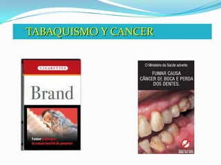    TABAQUISMO Y CANCER