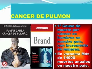 CANCER DE PULMON1ª Causa de muerte por cáncer en hombres en nuestro país, con incremento en mujeres.En varones: Más de 14000 muertes anuales en nuestro país.