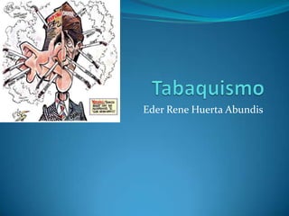 Tabaquismo EderRene Huerta Abundis 