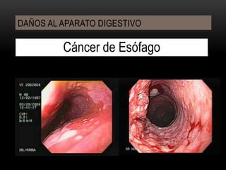 DAÑOS A LA SALUDNo hay diferencia para quienes fuman o son pasivos, pues los daños a la salud son comunes para ambos casos, ya sea a corto o largo plazo.