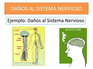 DAÑOS AL SISTEMA NERVIOSOEjemplo: Daños al Sistema Nervioso