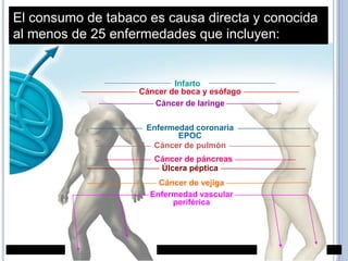 El consumo de tabaco es causa directa y conocida
al menos de 25 enfermedades que incluyen:


                           Infarto
                   Cáncer de boca y esófago
                      Cáncer de laringe

                     Enfermedad coronaria
                            EPOC
                      Cáncer de pulmón
                      Cáncer de páncreas
                       Úlcera péptica
                       Cáncer de vejiga
                     Enfermedad vascular
                          periférica
 