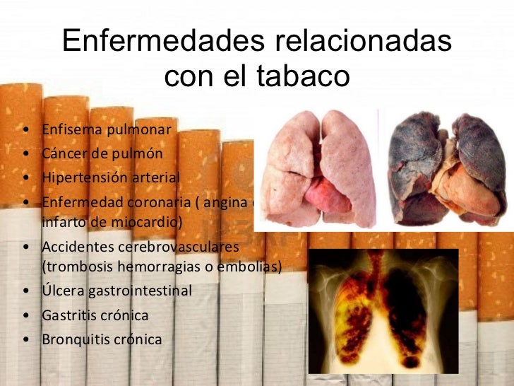 10 Enfermedades Causadas Por El Alcohol Y El Tabaco es.slideshare.net