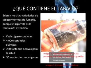 ¿QUÉ CONTIENE EL TABACO?
Existen muchas variedades de
tabaco y formas de fumarlo,
aunque el cigarrillo es la
forma más extendida
• Cada cigarro contiene:
 4.000 sustancias
químicas
 250 sustancia nocivas para
la salud
 50 sustancias cancerígenas
Imagen 3. Componentes del tabaco
Imagen 4. Alquitrán acumulado en los
pulmones tras haber fumado 400 cigarrillos
 