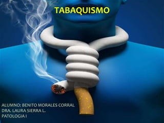 TABAQUISMO
TABAQUISMO
ALUMNO: BENITO MORALES CORRAL
DRA. LAURA SIERRA L.
PATOLOGIA I
 