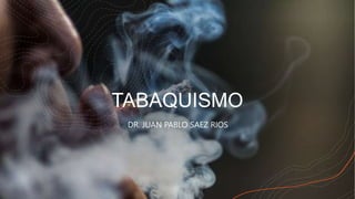 TABAQUISMO
DR. JUAN PABLO SAEZ RIOS
 