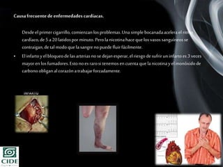 Page 11
Causafrecuente de enfermedades cardíacas.
Desdeel primercigarrillo, comienzanlos problemas.Una simple bocanadaacelera el ritmo
cardíaco,de 5 a20 latidosporminuto.Perola nicotinahace que los vasossanguíneosse
contraigan,de talmodoque la sangreno puedefluir fácilmente.
• El infartoy elbloqueode las arteriasno sedejanesperar,el riesgo de sufrirun infartoes 3 veces
mayoren los fumadores.Estonoes rarosi tenemos en cuentaque lanicotinayel monóxidode
carbonoobliganal corazóna trabajarforzadamente.
 