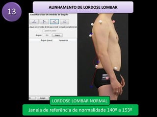 13
ALINHAMENTO DE LORDOSE LOMBAR
Janela de referência de normalidade 140º a 153º
LORDOSE LOMBAR NORMAL
 