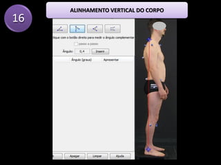 16
ALINHAMENTO VERTICAL DO CORPO
 
