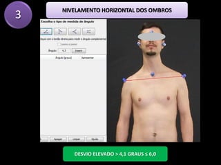 3
DESVIO ELEVADO > 4,1 GRAUS ≤ 6,0
NIVELAMENTO HORIZONTAL DOS OMBROS
 