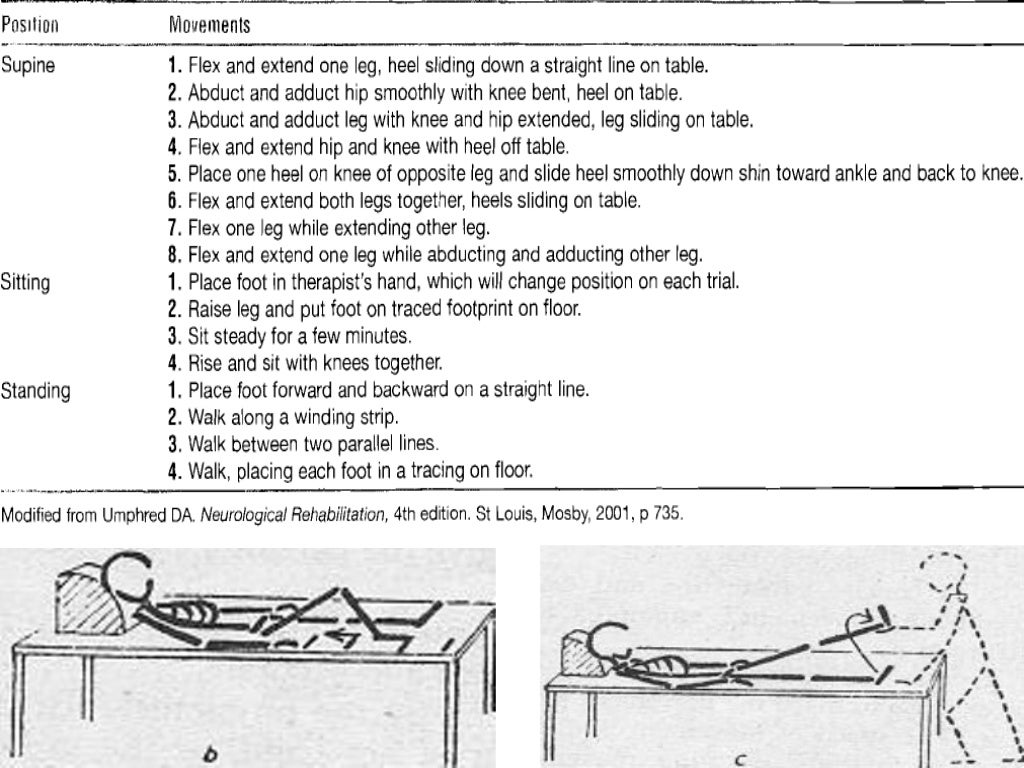 Tabes Dorsalis and Physiotherapy