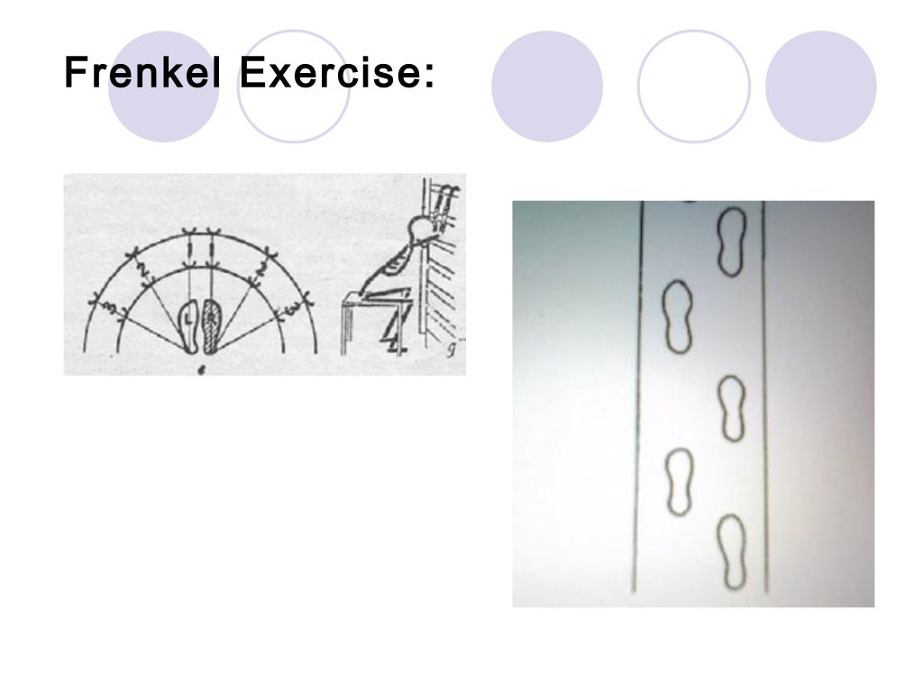 Tabes Dorsalis and Physiotherapy