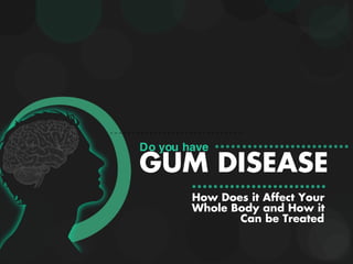 GUM DISEASE
Do you have
How Does it Affect Your
Whole Body and How it
Can be Treated
 
